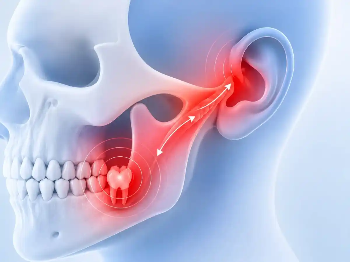 Pain That Spreads to Jaw or Ear