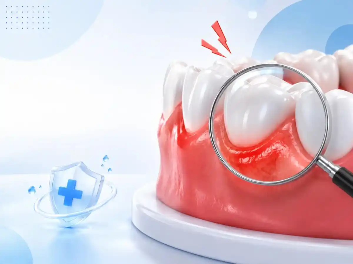 Swollen or Tender Gums