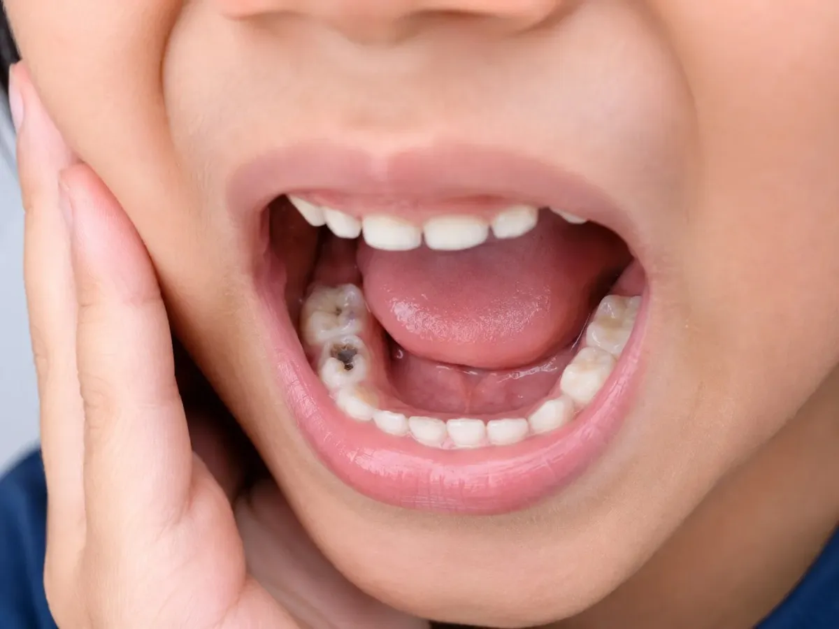 Complaints of Tooth Pain