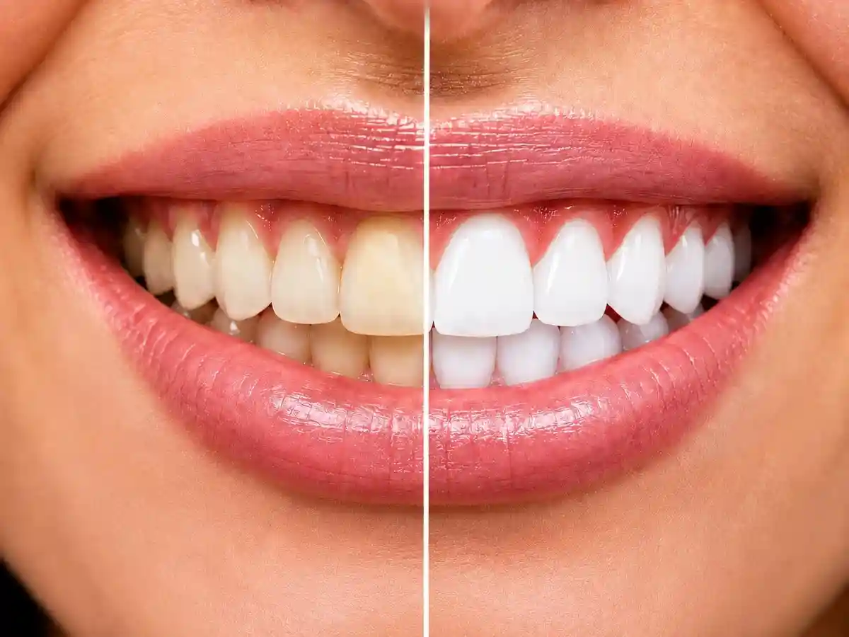 Faster, More Noticeable Results