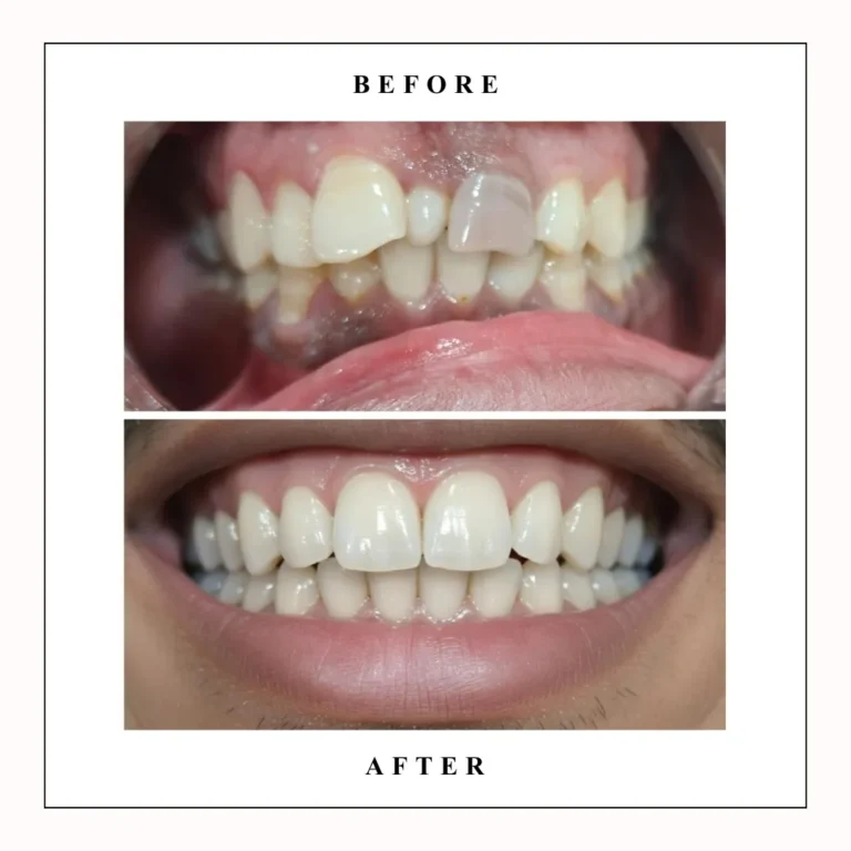 smile design in gurgaon